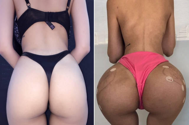 This Brazilian Model Is On A Mission For Kim Kardashian-Like Butt Or Death This Brazilian Model Is On A Mission For Kim Kardashian-Like Butt Or Death
