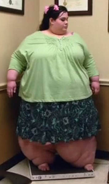 When Dedication Triumphs Over The Obesity When Dedication Triumphs Over The Obesity