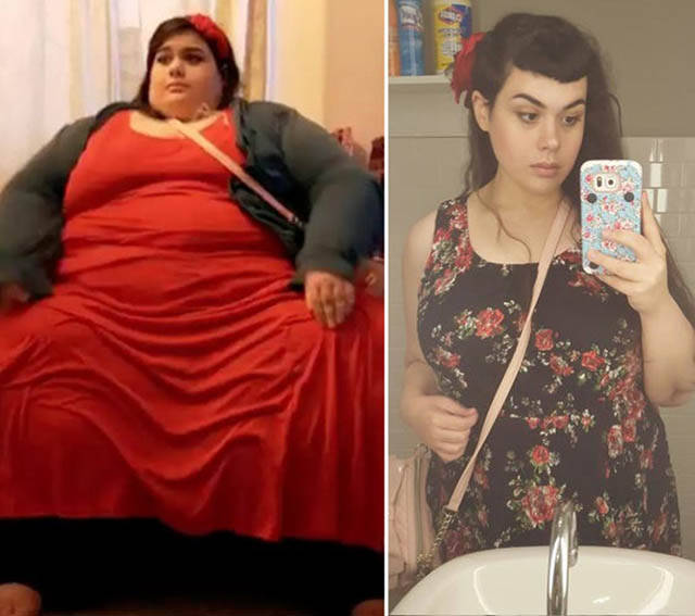 When Dedication Triumphs Over The Obesity When Dedication Triumphs Over The Obesity
