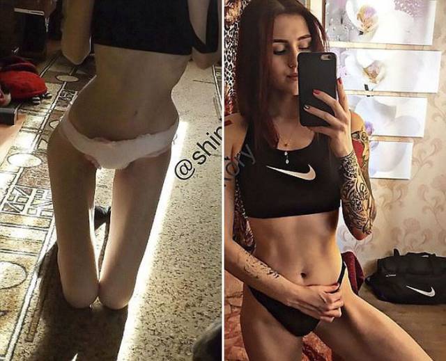 This Russian Teen Has Proved That Anorexia Cant Stop You