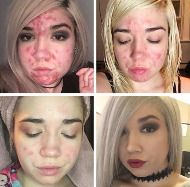 People Who Had The Will To Change Their Lives