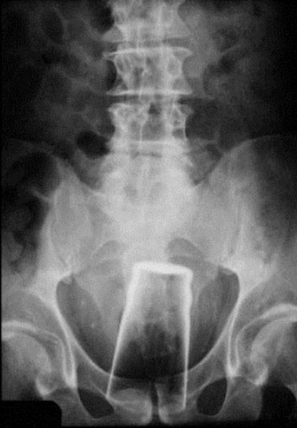 X-Rays That Will Make You Very Uncomfortable