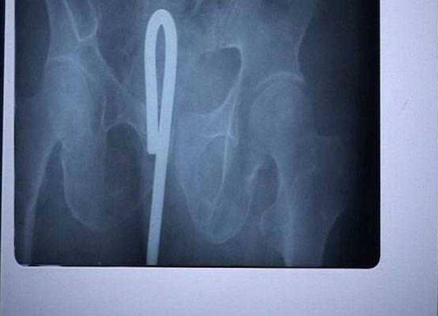 X-Rays That Will Make You Very Uncomfortable