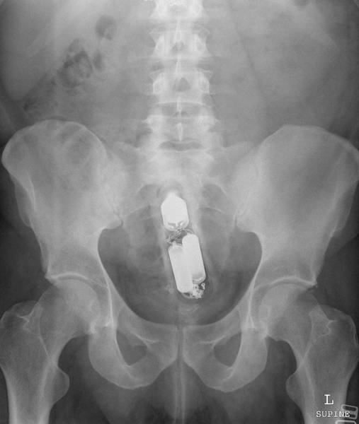 X-Rays That Will Make You Very Uncomfortable