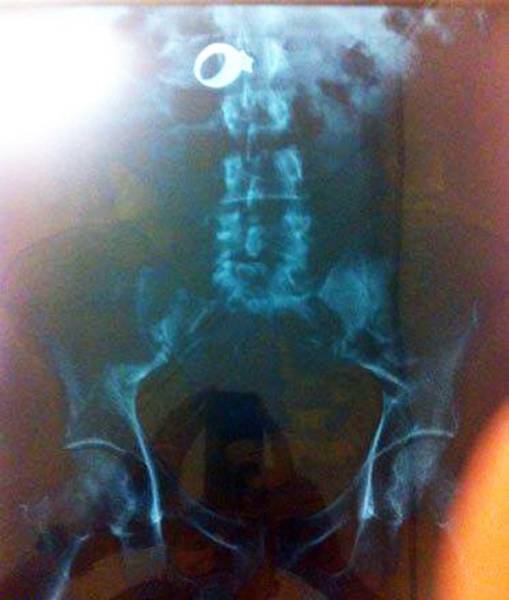 X-Rays That Will Make You Very Uncomfortable