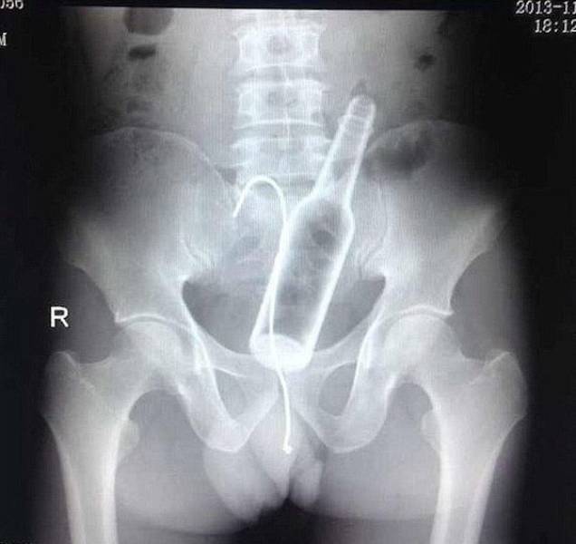 X-Rays That Will Make You Very Uncomfortable