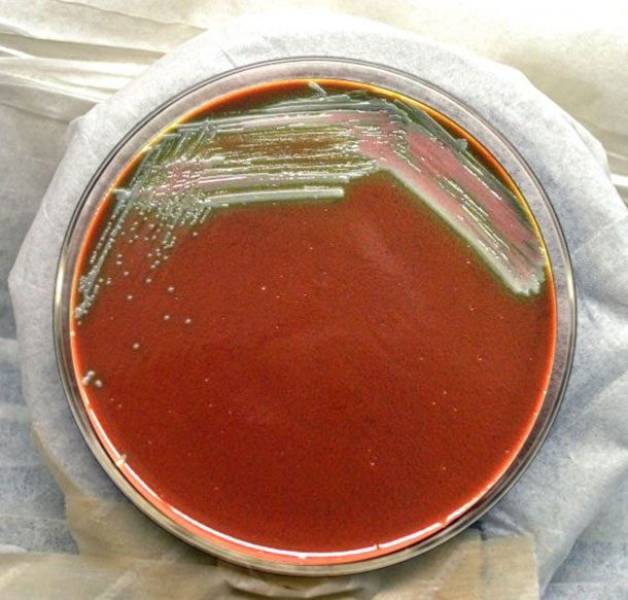 Our Food Contains All Sorts Of Strange Ingredients