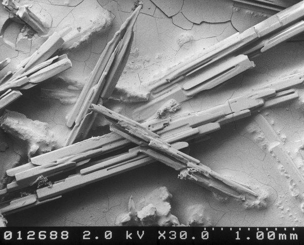 Foto Microskop Es yang Unik dan Menakjubkan