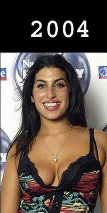3 Degradation of Amy Winehouse 6 pics 