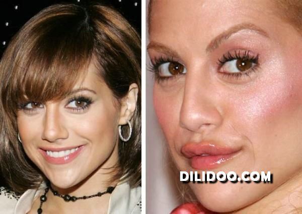 Ugly Plastic Surgery