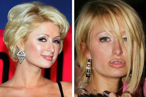 When plastic surgery fails (38 pics)