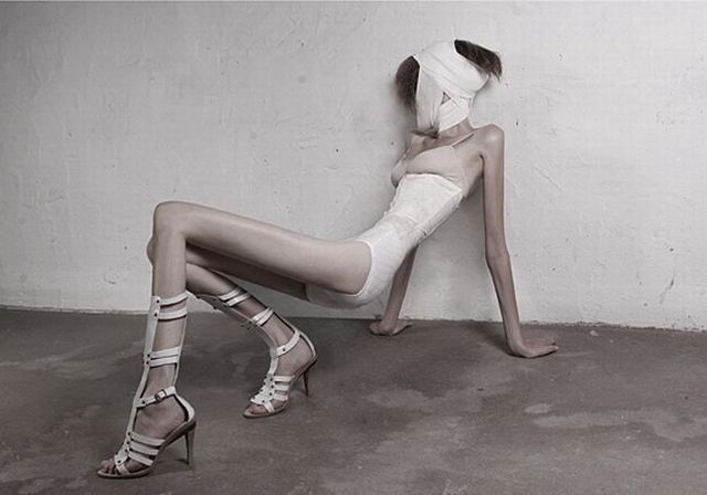 Anorexia � it�s terrifying! (14 pics)