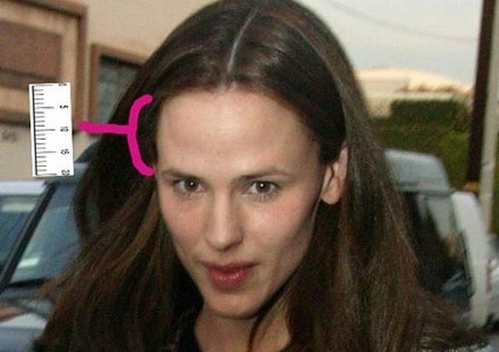 Celebrities with big foreheads (20 pics) - Izismile.com