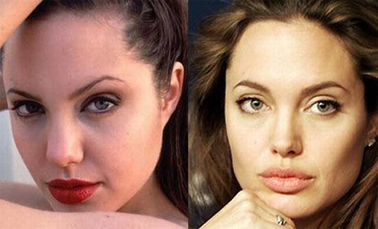 43 Stars before and after plastic surgery 47 pics 