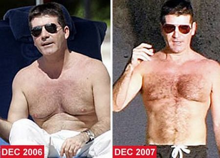 Man boobs (16 pics)