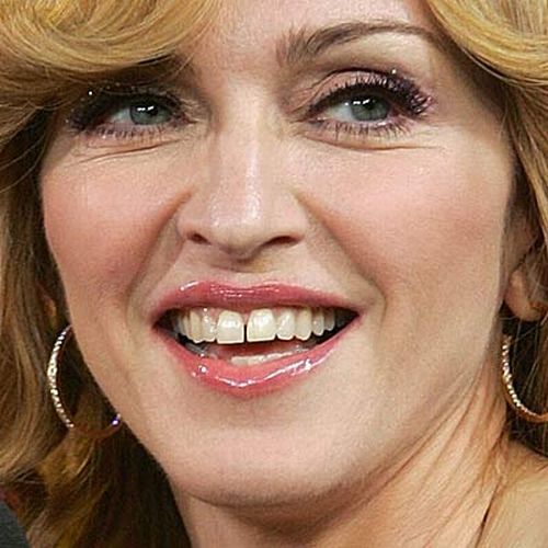 Celebrities with Bad Teeth (13 pics) - Izismile.com
