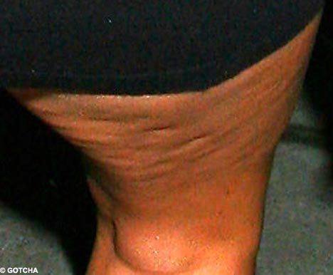 Celebrities and Their Imperfections! (58 pics)