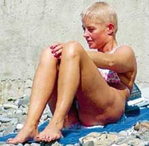 Celebrities and Their Imperfections! (58 pics)