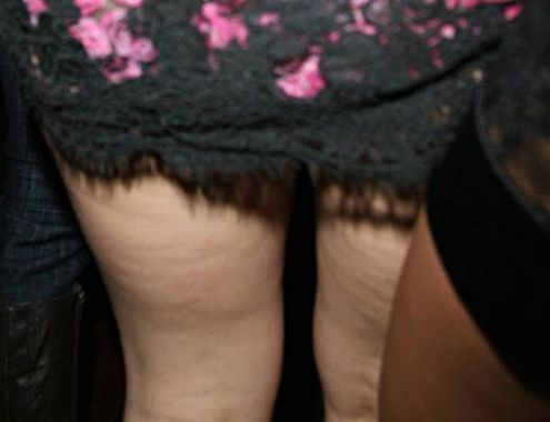 Celebrities and Their Imperfections! (58 pics)
