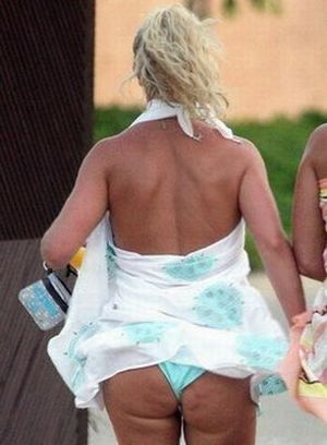 Celebrities and Their Imperfections! (58 pics)