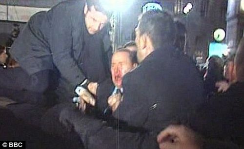 Berlusconi Gets a Broken Nose and Loses Two Teeth during the Assault (7 pics+1 video)