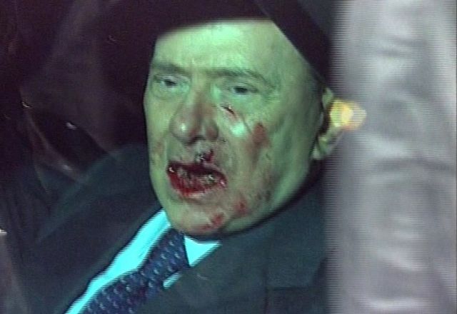 Berlusconi Gets a Broken Nose and Loses Two Teeth during the Assault (7 pics+1 video)