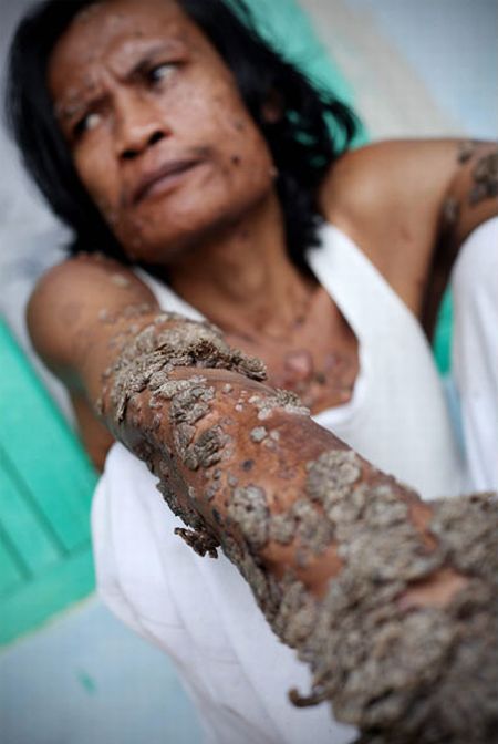 Have You Ever Seen a Tree Man? (19 pics)
