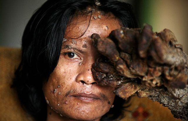 Have You Ever Seen a Tree Man? (19 pics)