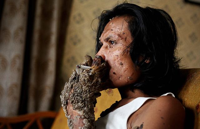 Have You Ever Seen a Tree Man? (19 pics)