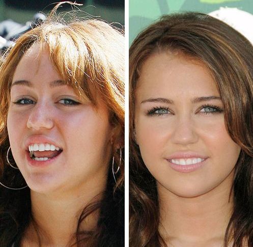 Miley Cyrus Celebrities with and without Make-Up (28 pics)