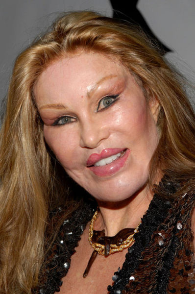 jocelyn wildenstein 2010. Jocelyn Wildenstein