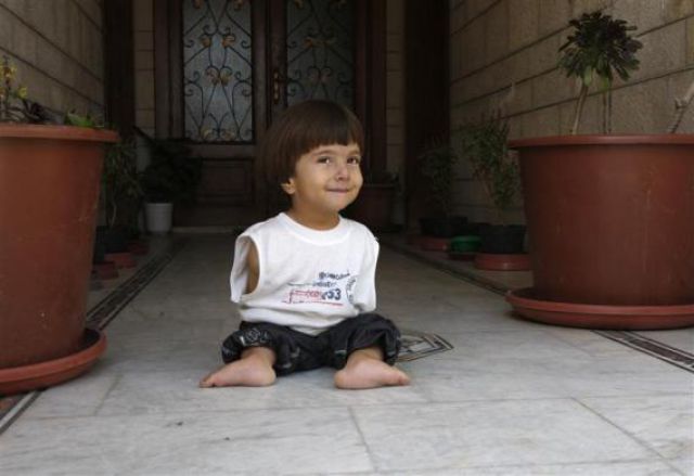 Little Boy without Arms (14 pics)