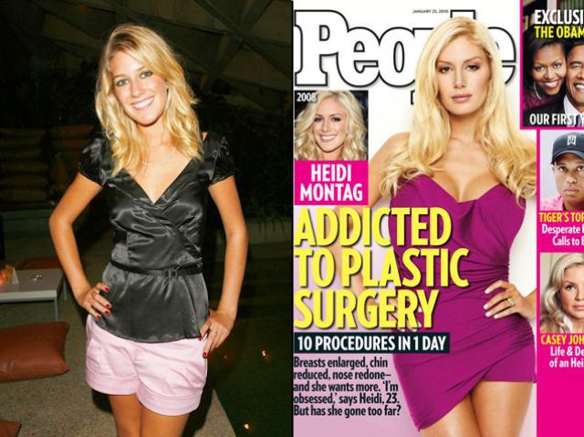 heidi montag before and after all. heidi montag plastic surgery