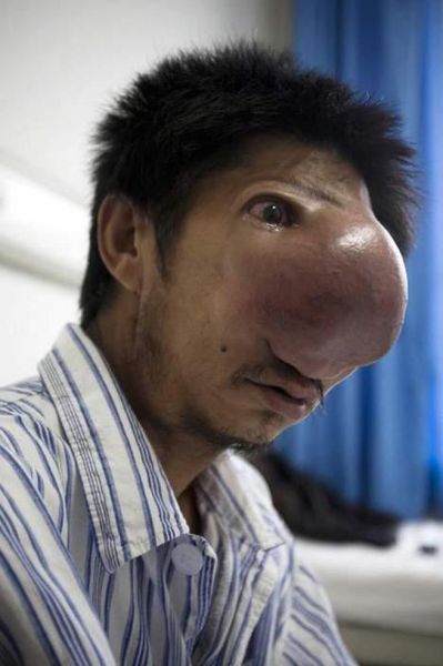 The Man with the Huge Nose (12 pics)