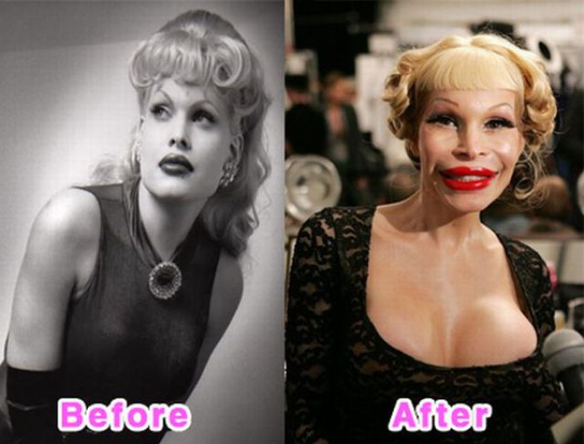 Celebrity Before and After