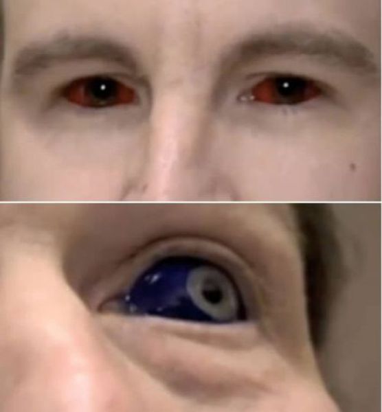 Horrible Self-made Tattoos