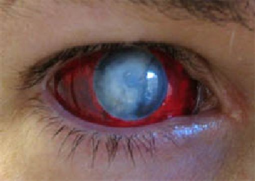 Eerie Eyeball Covers