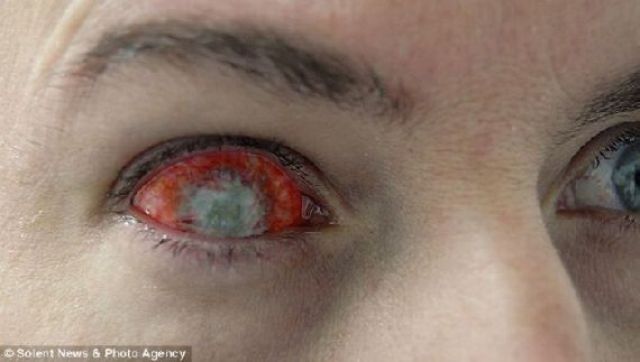 Eerie Eyeball Covers