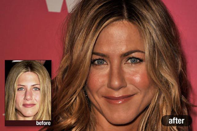 Jennifer Aniston Plastic Surgery Before After. Jennifer Aniston. Plastic