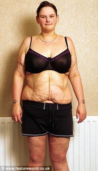 Anorexic Fat 11