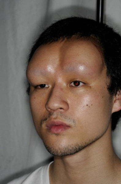 Disturbing Forehead Modifications by Japanese Kids