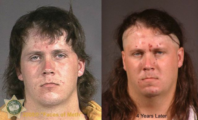 Meth Faces Pictures