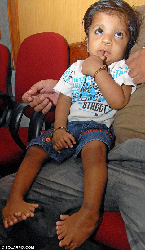Boy Born With 34 Fingers and Toes
