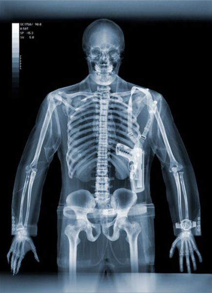 Amazing X-Ray Artwork (43 pics) - Izismile.com