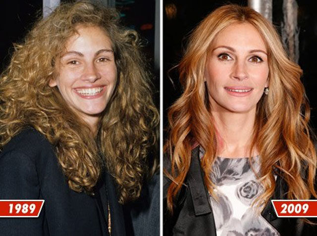 Celebrity Plastic Surgery Before & After (56 pics) - Izismile.com