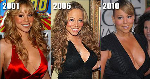 Celebrity Plastic Surgery Before & After