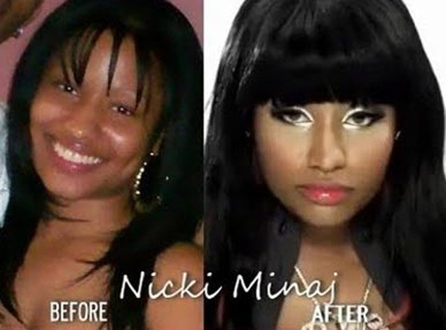 Celebrity Plastic Surgery Before & After