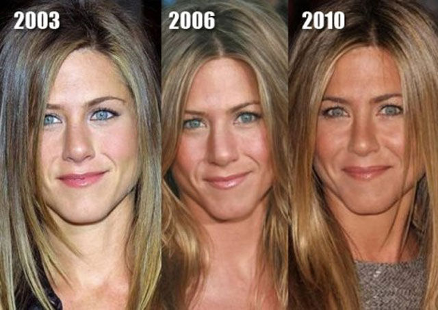 Jennifer Aniston Before and After Plastic Surgery