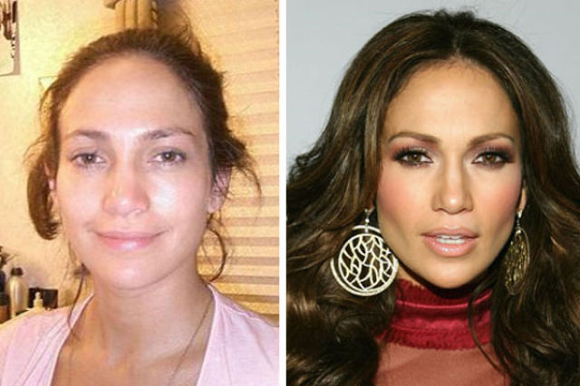 Celebrity Plastic Surgery Before & After