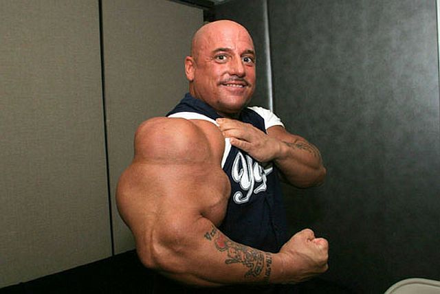 Another Synthol Victim